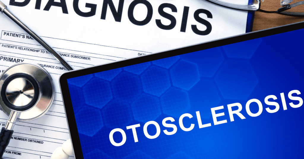 otosclerosis tinnitus being diagnosed