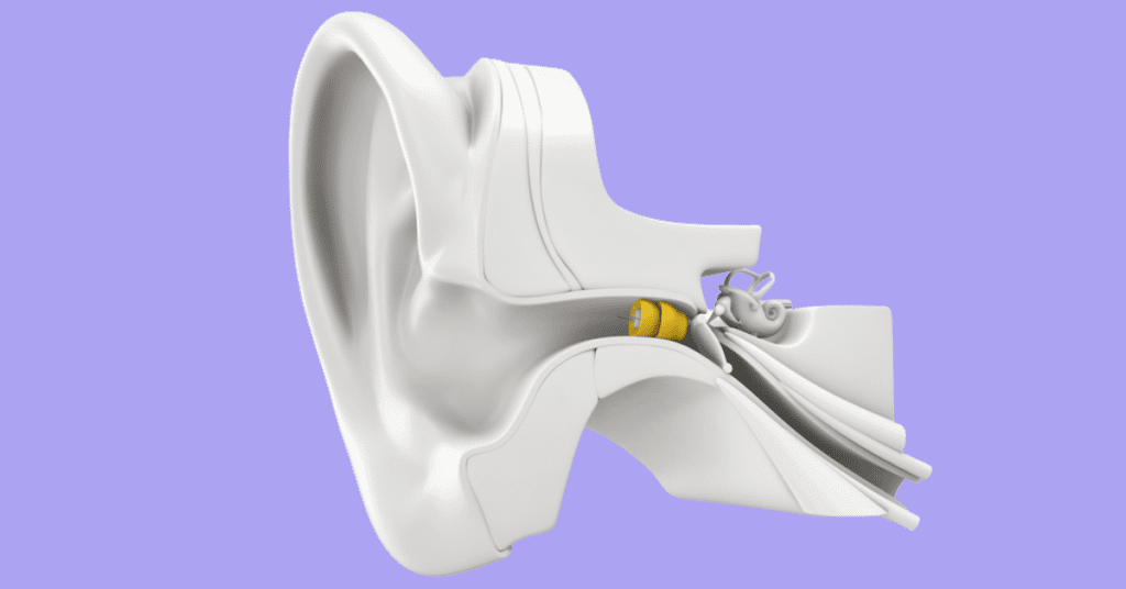 lyric hearing aid review