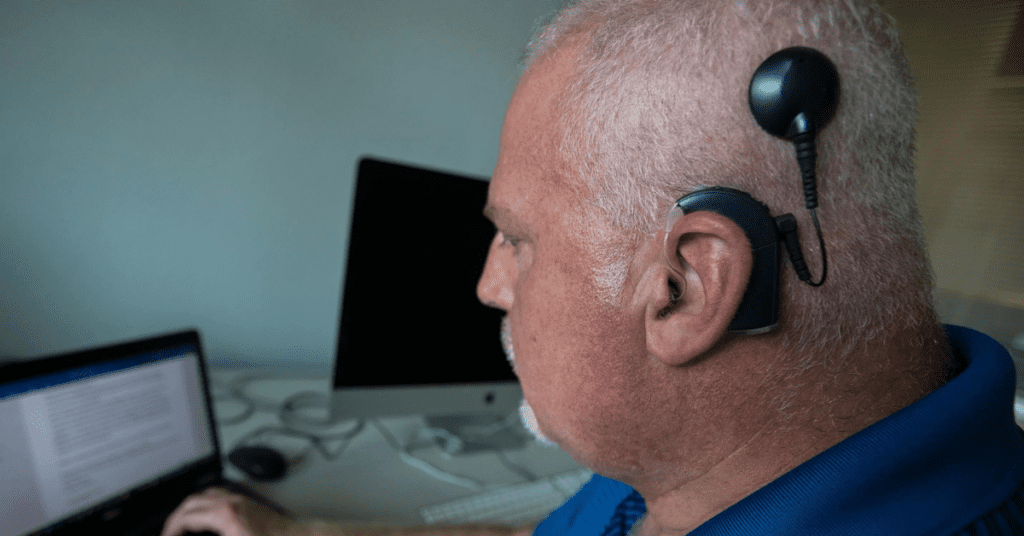 Cochlear Implants and Tinnitus | Treble Health