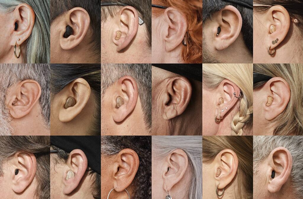 hearing aids being used for tinnitus