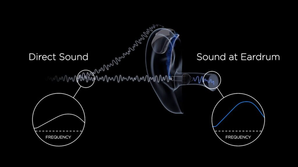 Widex puresound technology