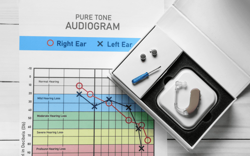 Pure tone audiogram